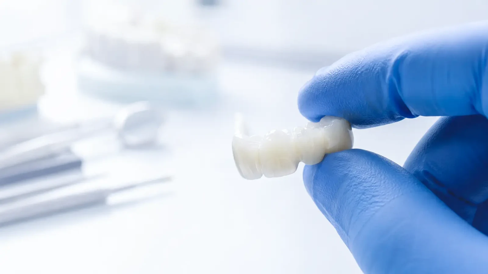 A dentist in blue gloves holding a porcelain dental bridge in a laboratory.