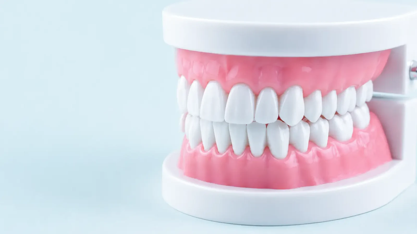 A dental teaching model showing the upper and lower teeth set into pink gums.