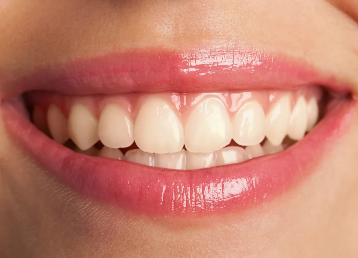 Smile before treatment