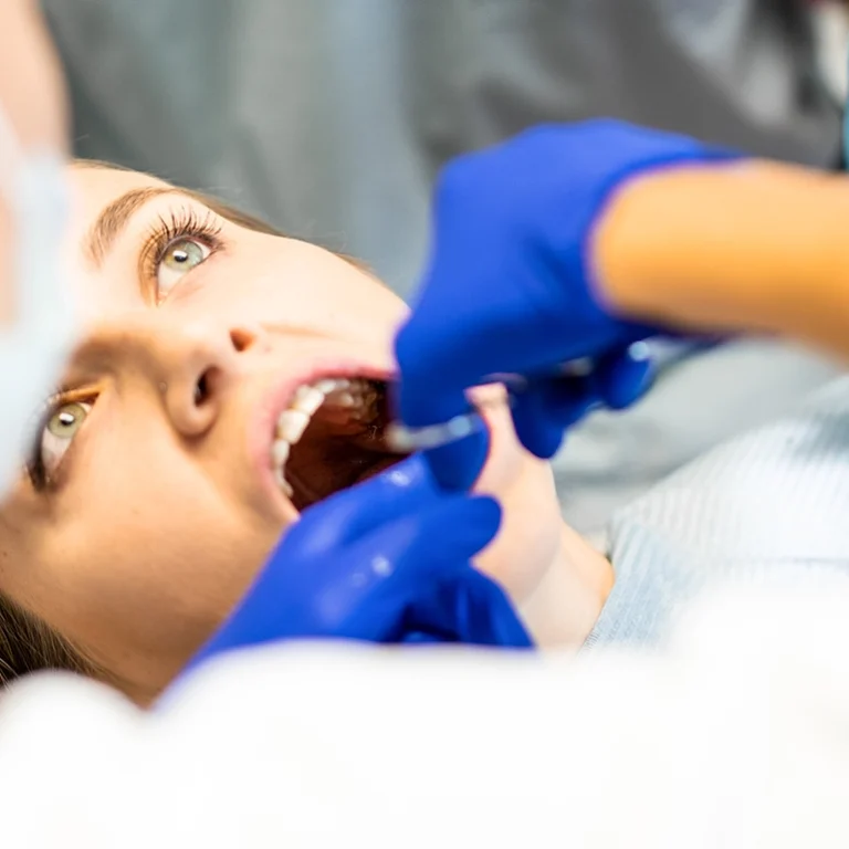 Wisdom Tooth Removal & Extractions